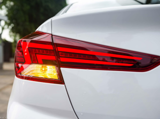 Mất Xi Nhân Bên Phụ: Nguyên Nhân & Cách Chỉnh Tại Tiken Auto